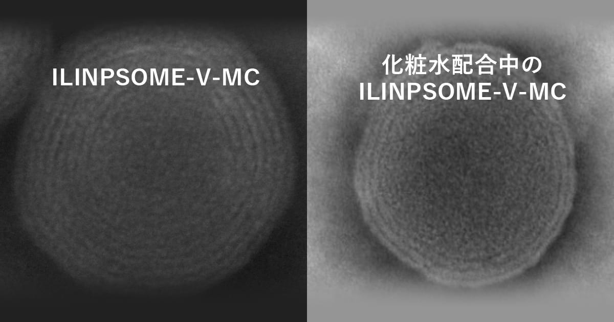 リポソーム（リン脂質ナノ粒子）